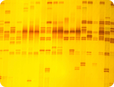 DNA fingerprinting chart